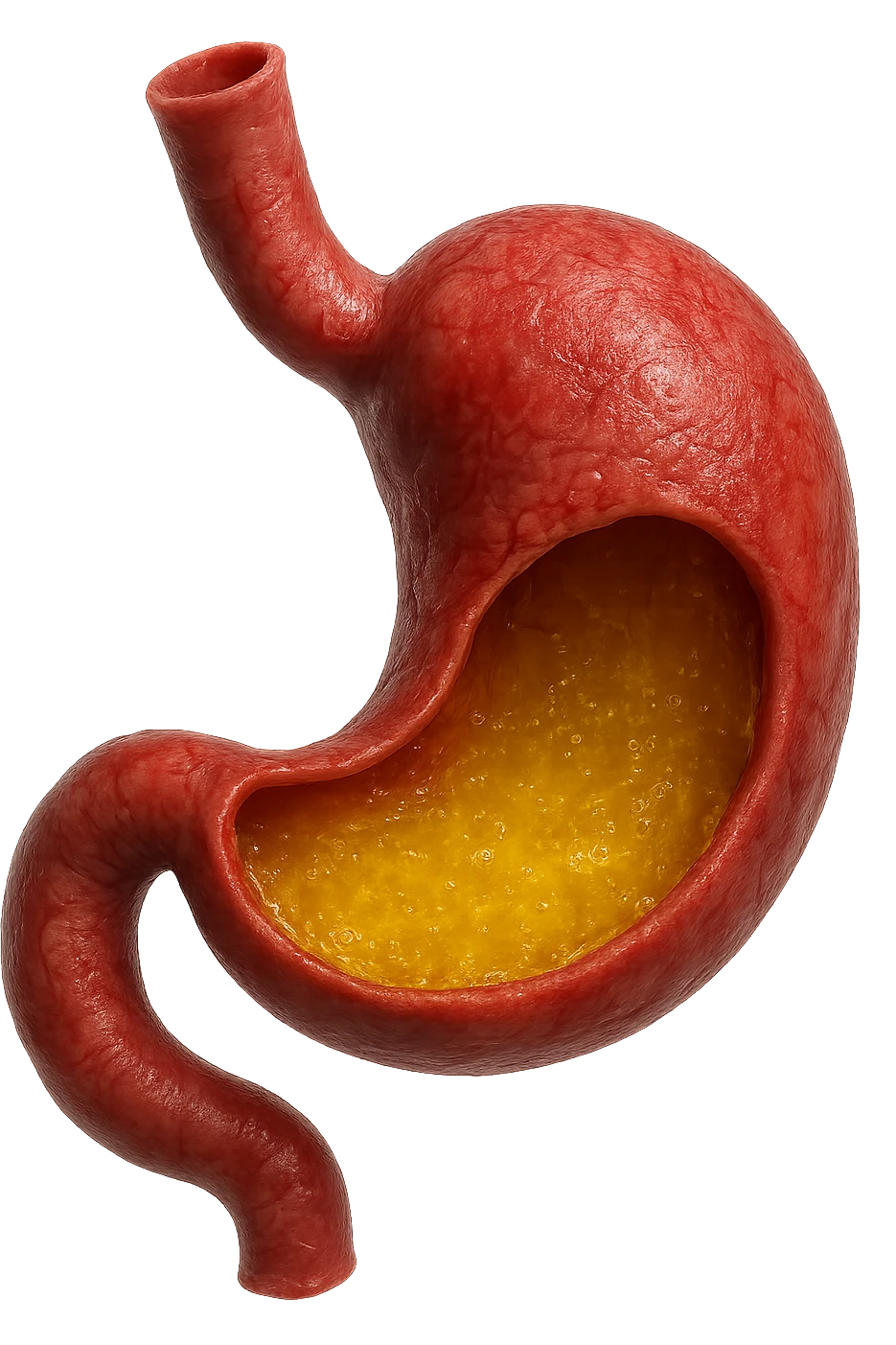 stomaco umano anatomico infiammato con acido giallo all'interno, iperrealistico 4k, isolato su sfondo bianco emoji