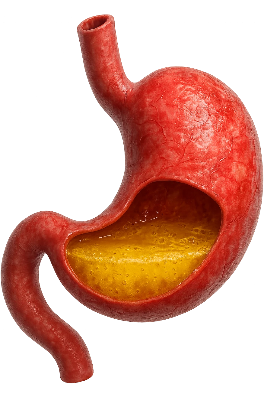 stomaco umano anatomico infiammato con acido giallo all'interno, iperrealistico 4k, isolato su sfondo bianco emoji