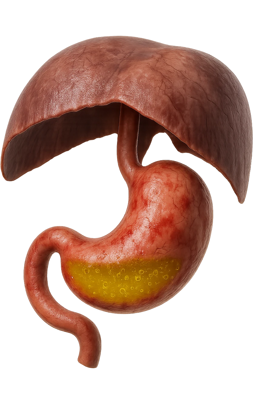 stomaco umano anatomico infiammato con acido giallo all'interno fluttua in aria insieme ad un diaframma umano, iperrealistico 4k, isolato su sfondo bianco emoji