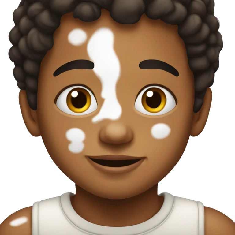 niño con vitiligo emoji