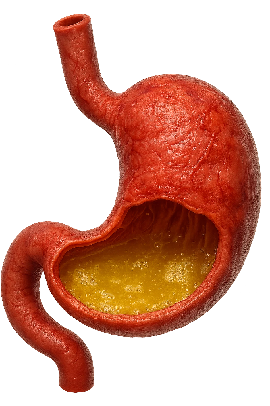 stomaco umano anatomico infiammato con acido giallo all'interno, iperrealistico 4k, isolato su sfondo bianco emoji