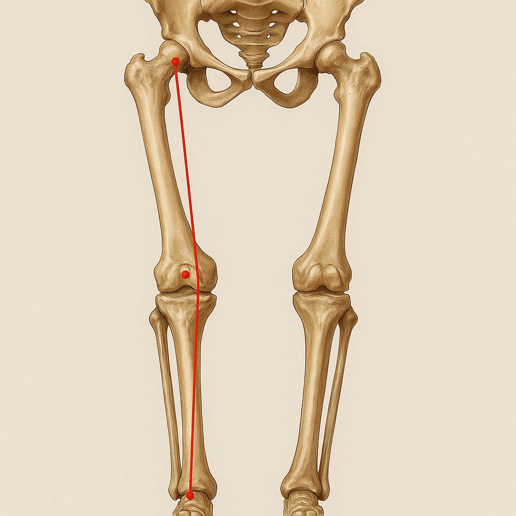 Hyperrealistic anatomical illustration 4K, rear view, 1:1 proportion, valgus knee (knock-knee) seen from the front, pelvis bones, femur, tibia, and fibula clearly highlighted, red mechanical axis line, realistic details, medical style, neutral background. emoji