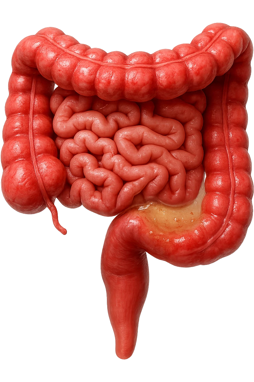 intestino anatomico umano affetto da gastroenterite, diarrea liquida nel colon ben visibile, iperrealistico 4k emoji