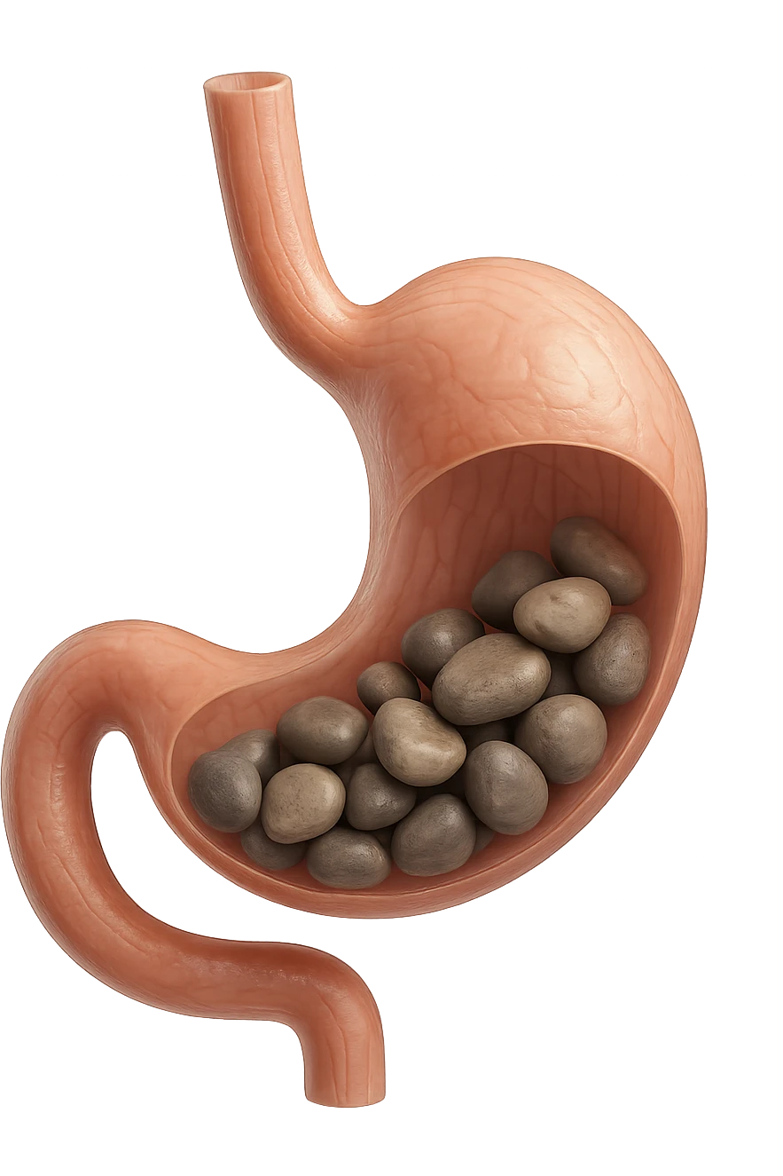 Sassi nello stomaco durante la digestione in 3d realistica emoji