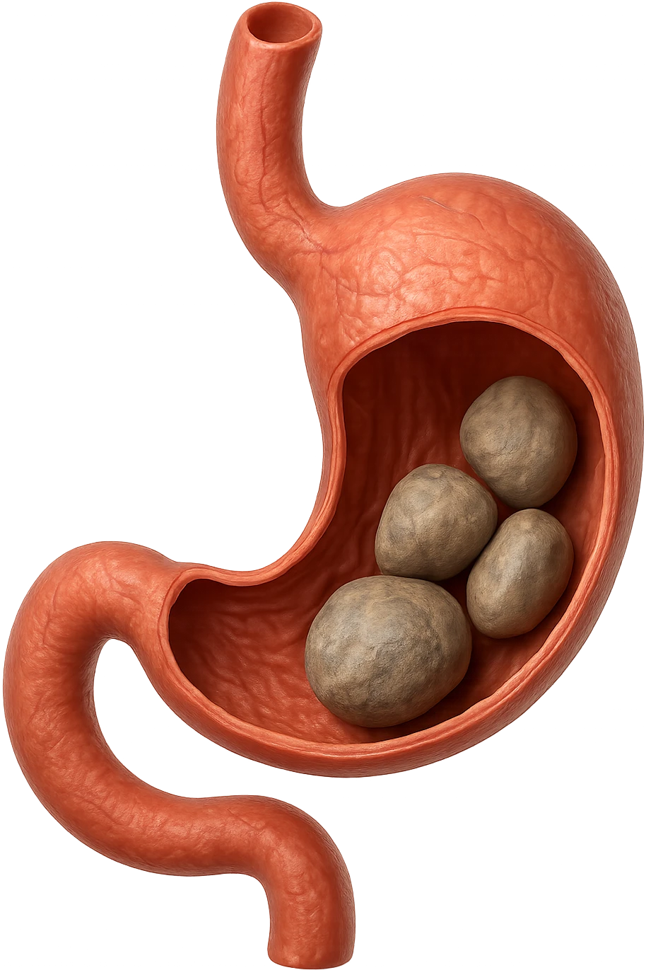 Sassi nello stomaco durante la digestione in 3d realistica emoji