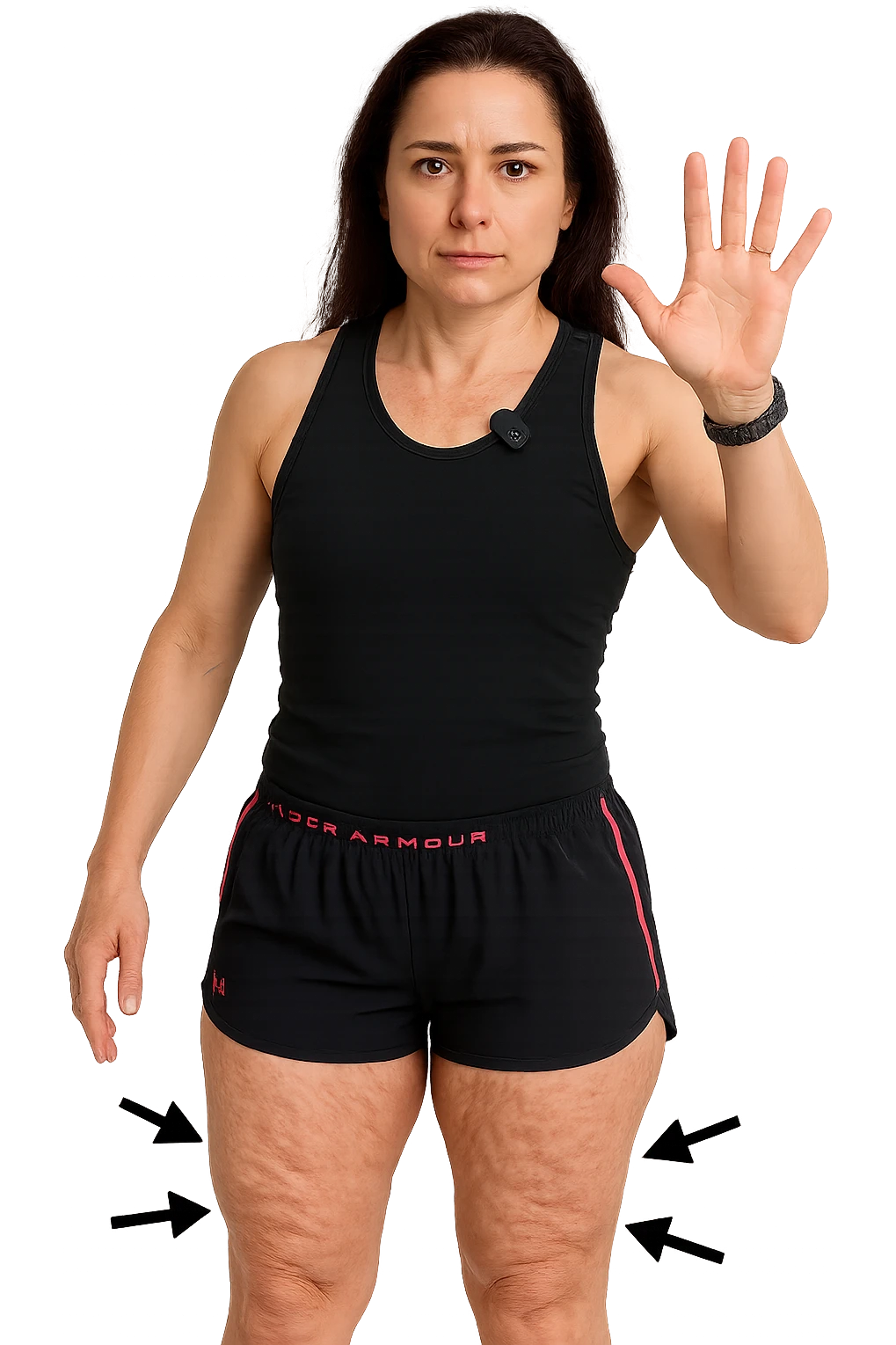 Donna con cellulite sulle cosce indica le cosce che sono infiammate di cellulite con frecce ad indicare  senza mano alzata come in foto. emoji