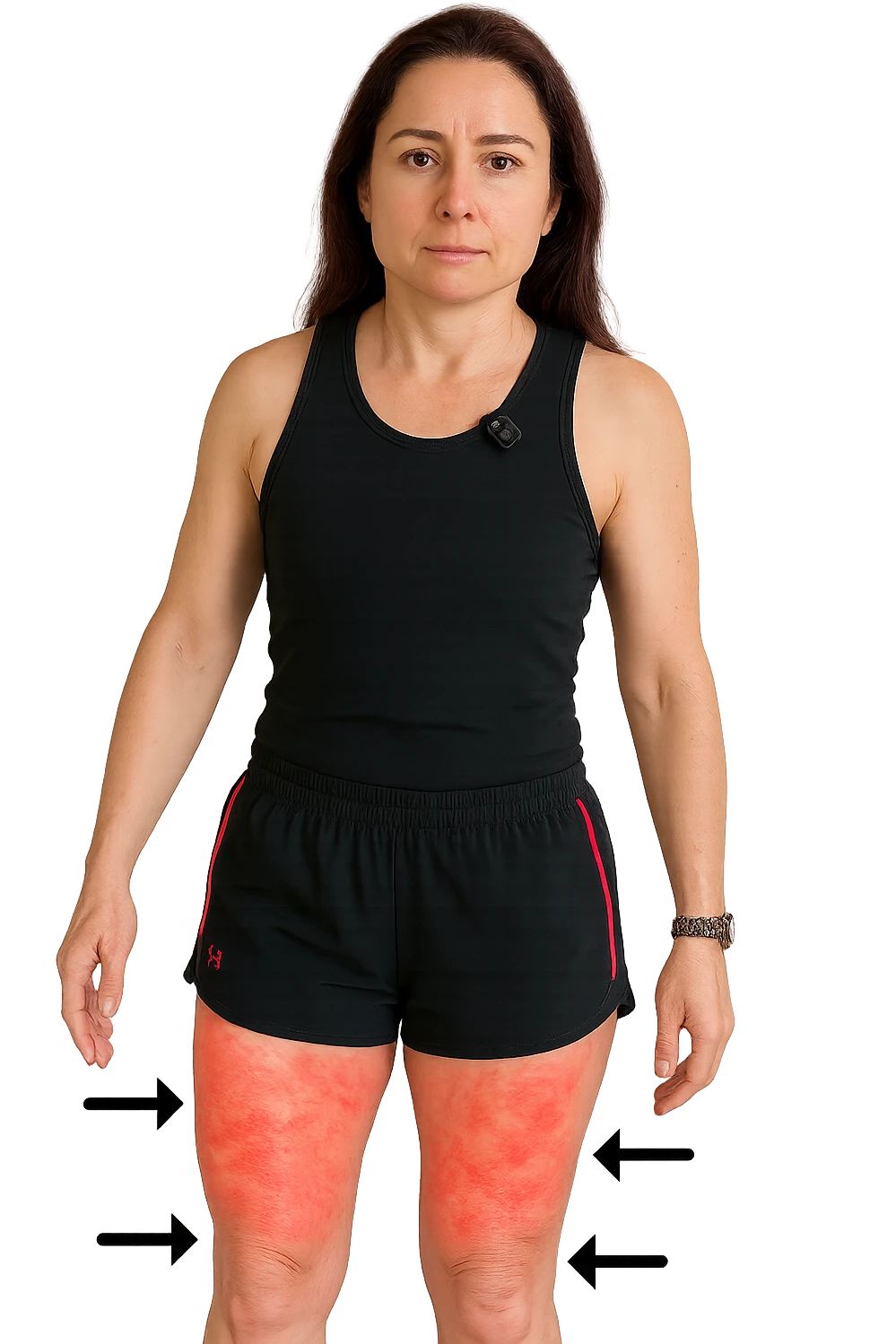 Donna con cellulite sulle cosce indica le cosce che sono infiammate di cellulite con frecce ad indicare  senza mano alzata come in foto. emoji