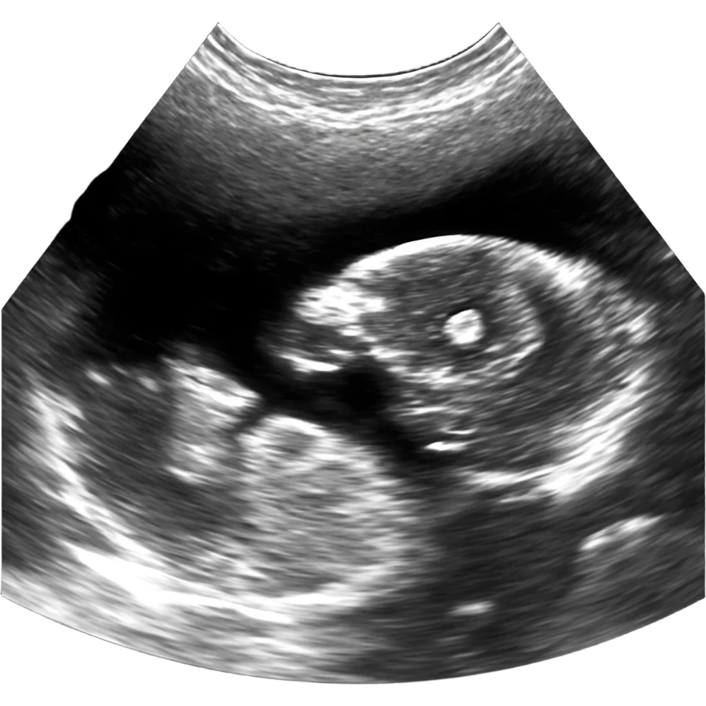 molar pregnancy emoji