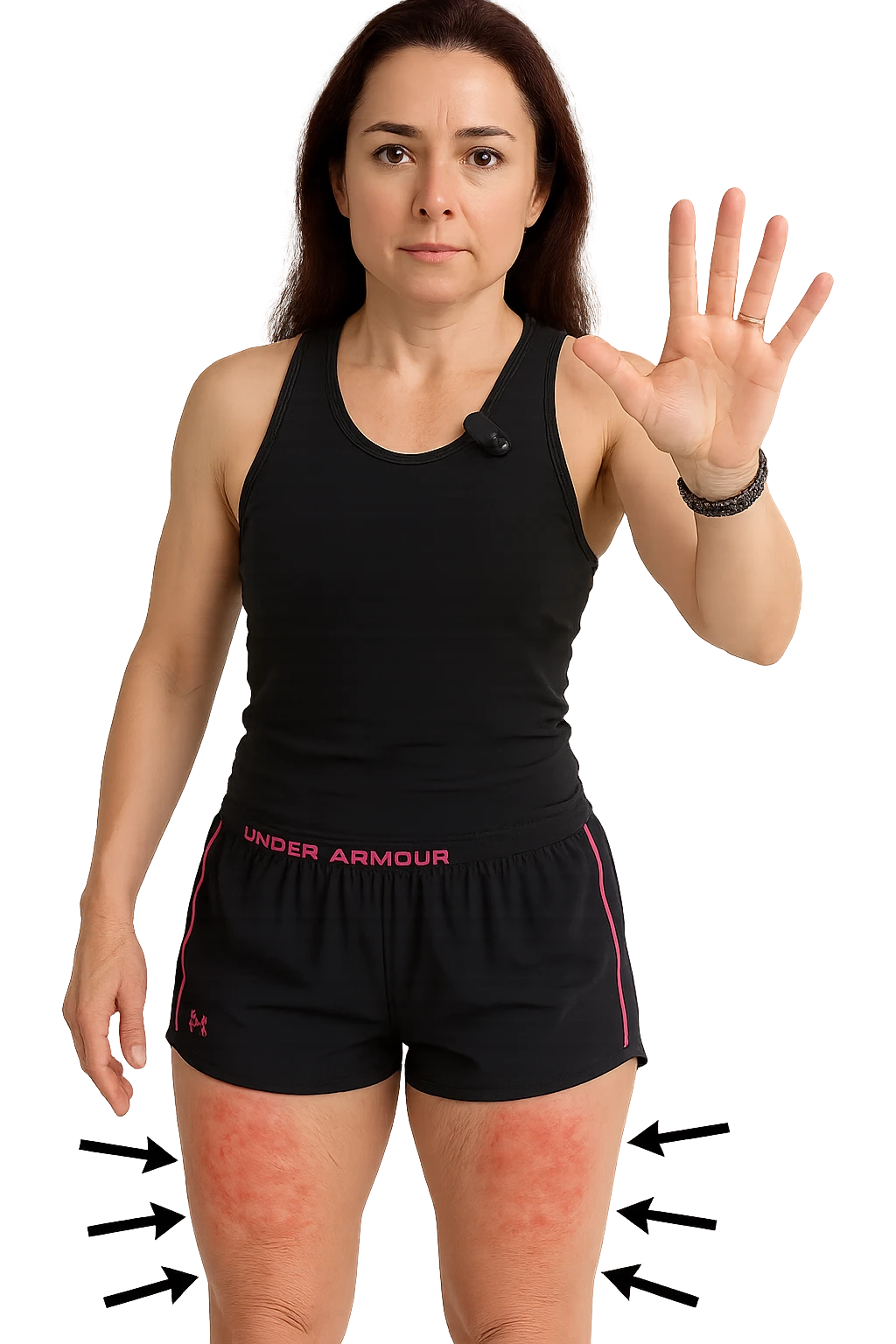 Donna con cellulite sulle cosce indica le cosce che sono infiammate di cellulite con frecce ad indicare  senza mano alzata come in foto. emoji