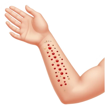 Allergy skin prick test on forearm with small red bumps showing reactions to different allergens sticker