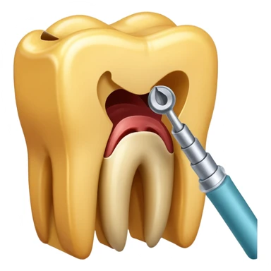 endodoncia dental con lima en la pulpaç sticker