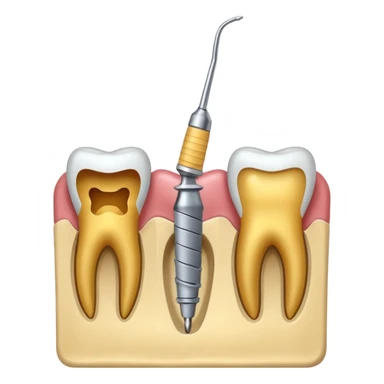 endodoncia dental con lima en la pulpaç sticker