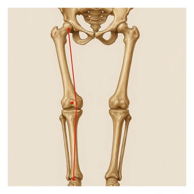 Hyperrealistic anatomical illustration 4K, rear view, 1:1 proportion, valgus knee (knock-knee) seen from the front, pelvis bones, femur, tibia, and fibula clearly highlighted, red mechanical axis line, realistic details, medical style, neutral background. sticker