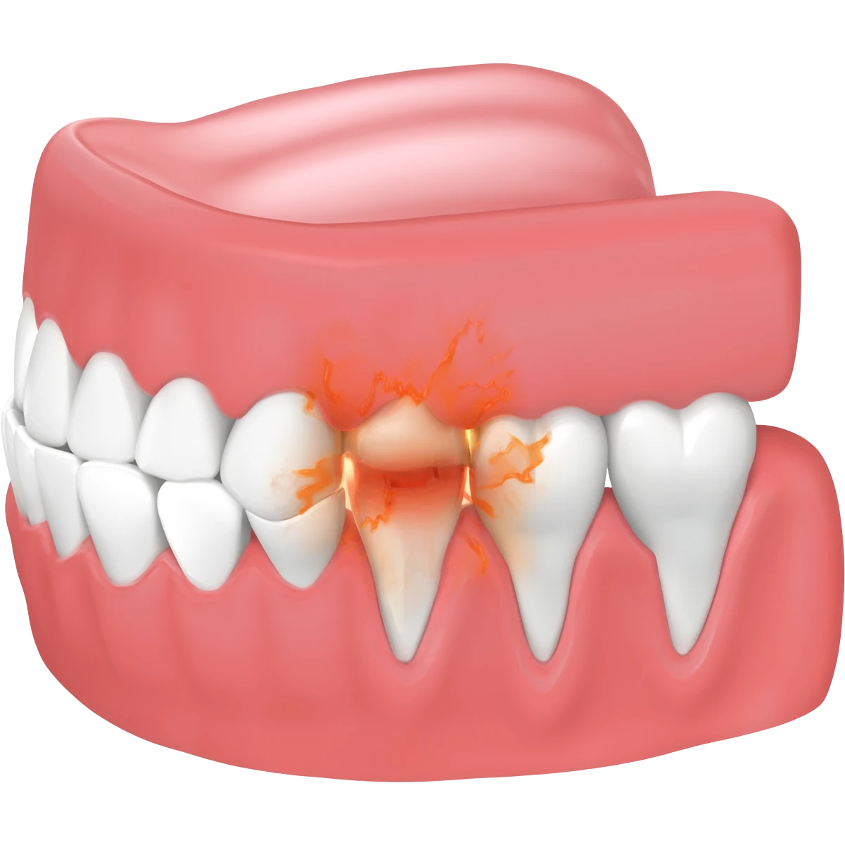 pericoronitis teeth emoji
