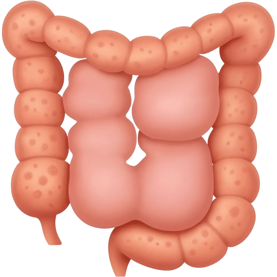 endoscopy for crohn's disease cobbestone emoji