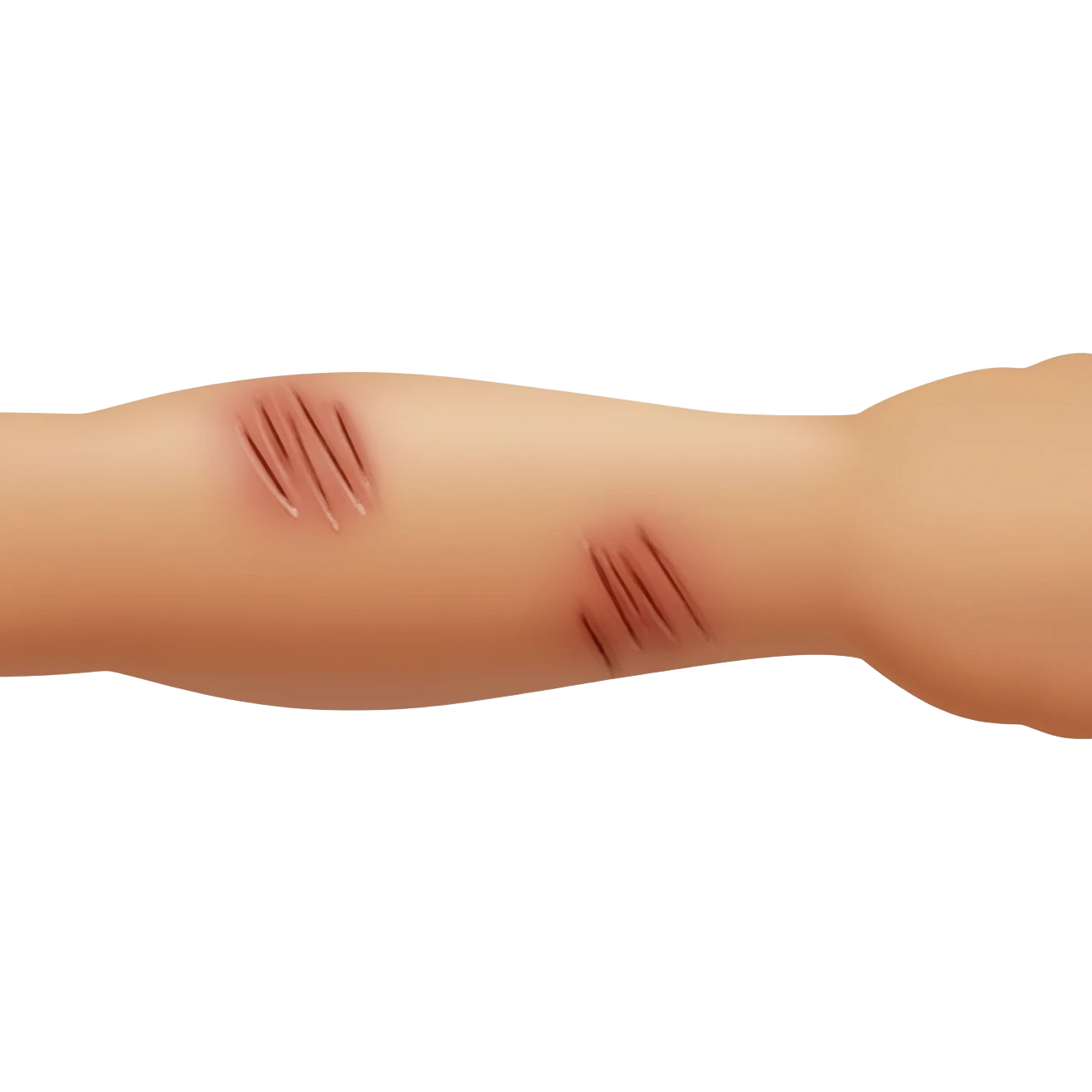 arm with scratches emoji