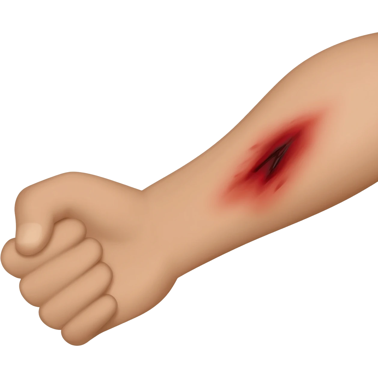arm with burns emoji