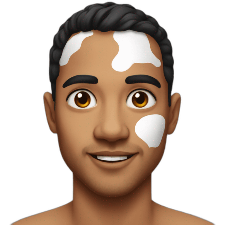 vitiligo on arab french 30 year old male emoji