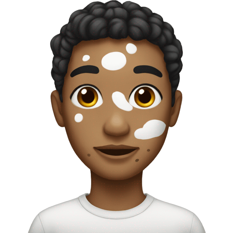 Vitiligo  emoji